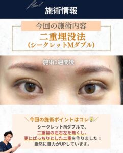 シークレットMダブル