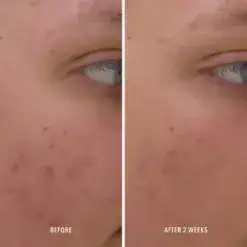 HydroPeptide Clear Rescue Serum