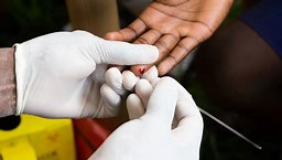 New Promising Approach to Fight HIV