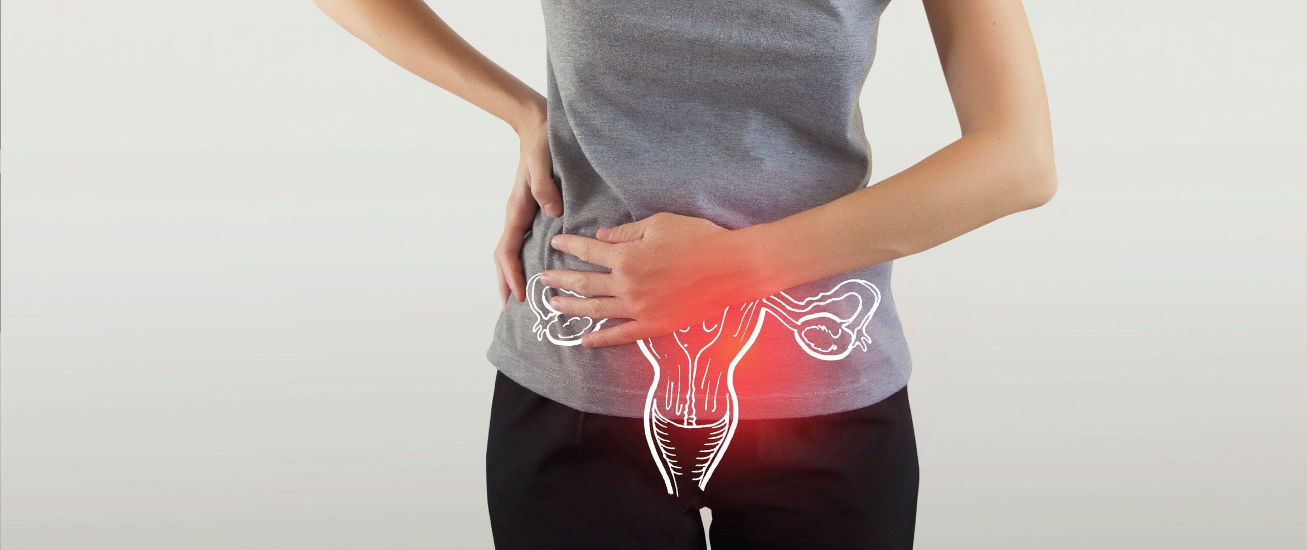 Polycystic_Ovary_Syndrome_PCOS_ad4de67678
