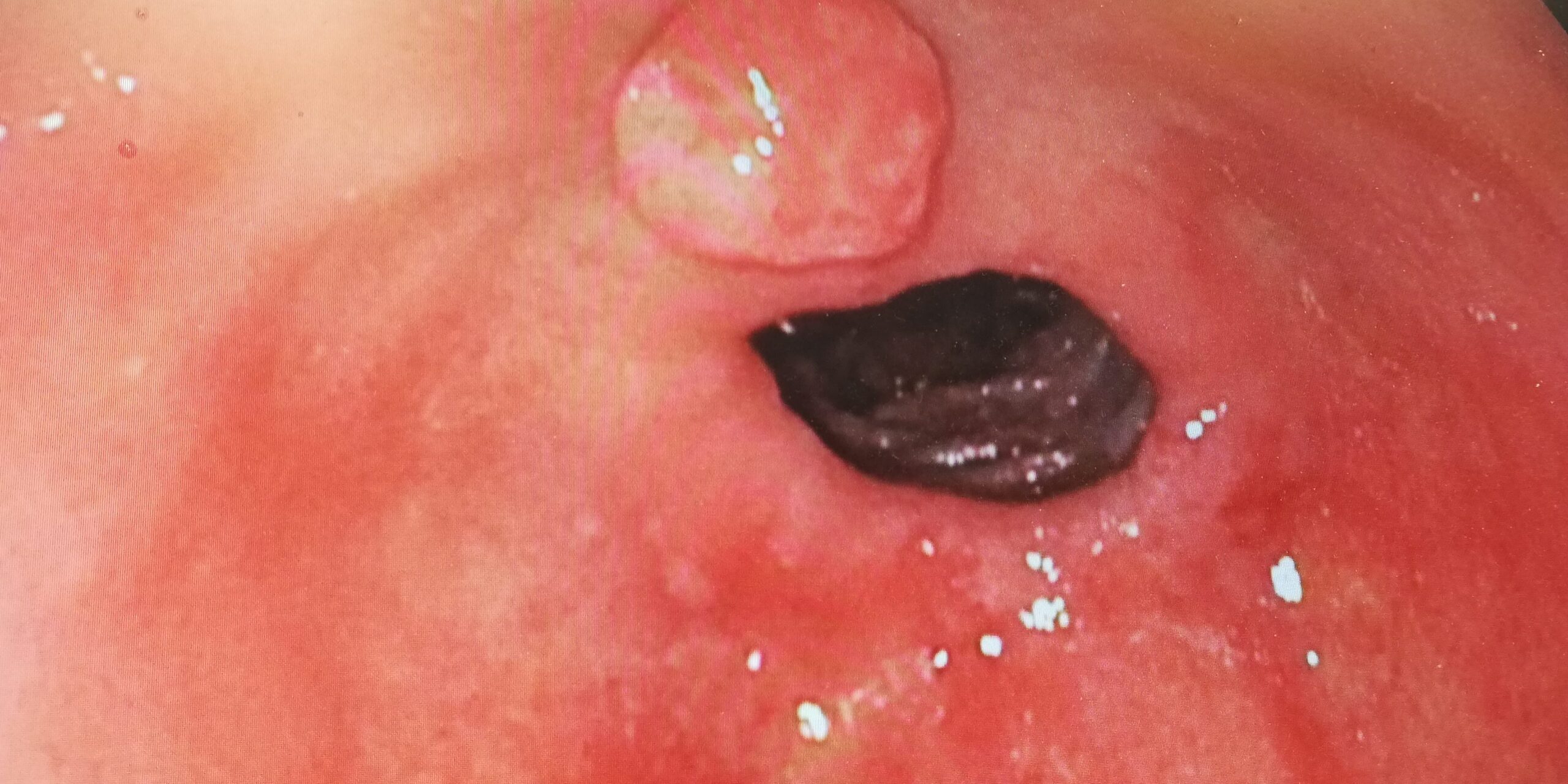 Anatomie Maagdarmstelsel