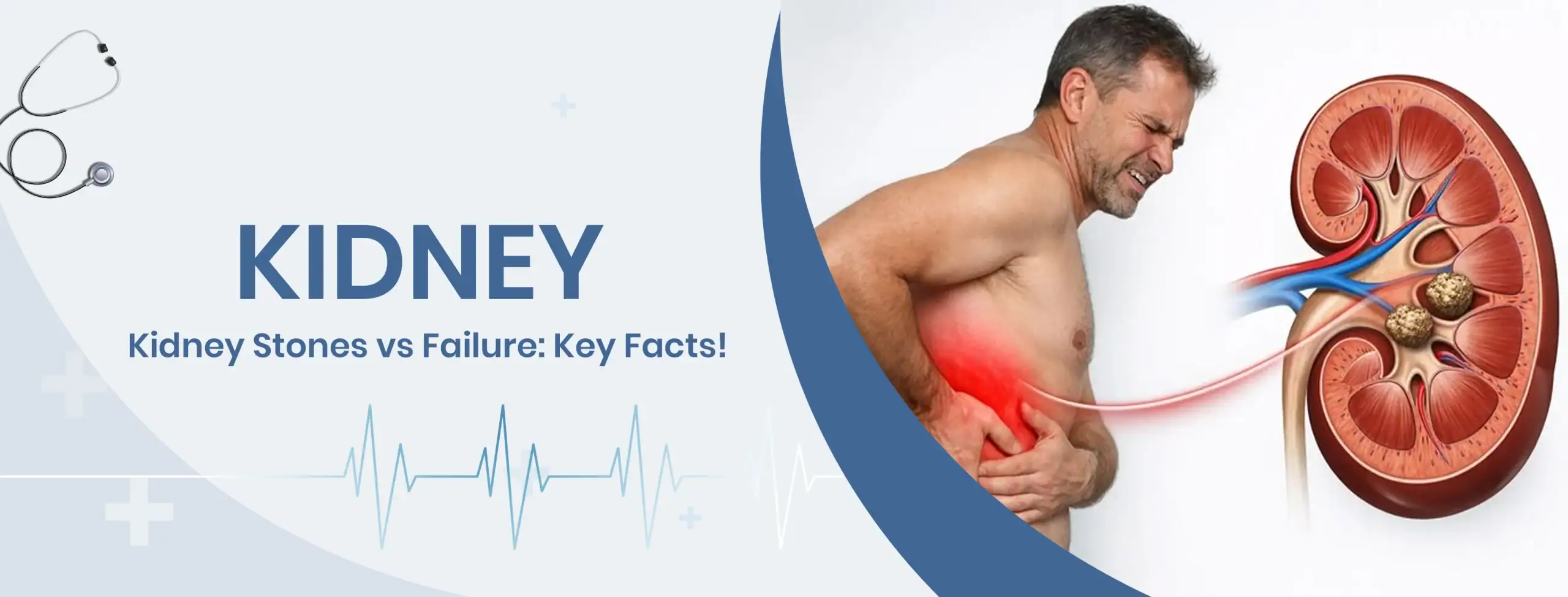Kidney Stones vs Failure Key Facts
