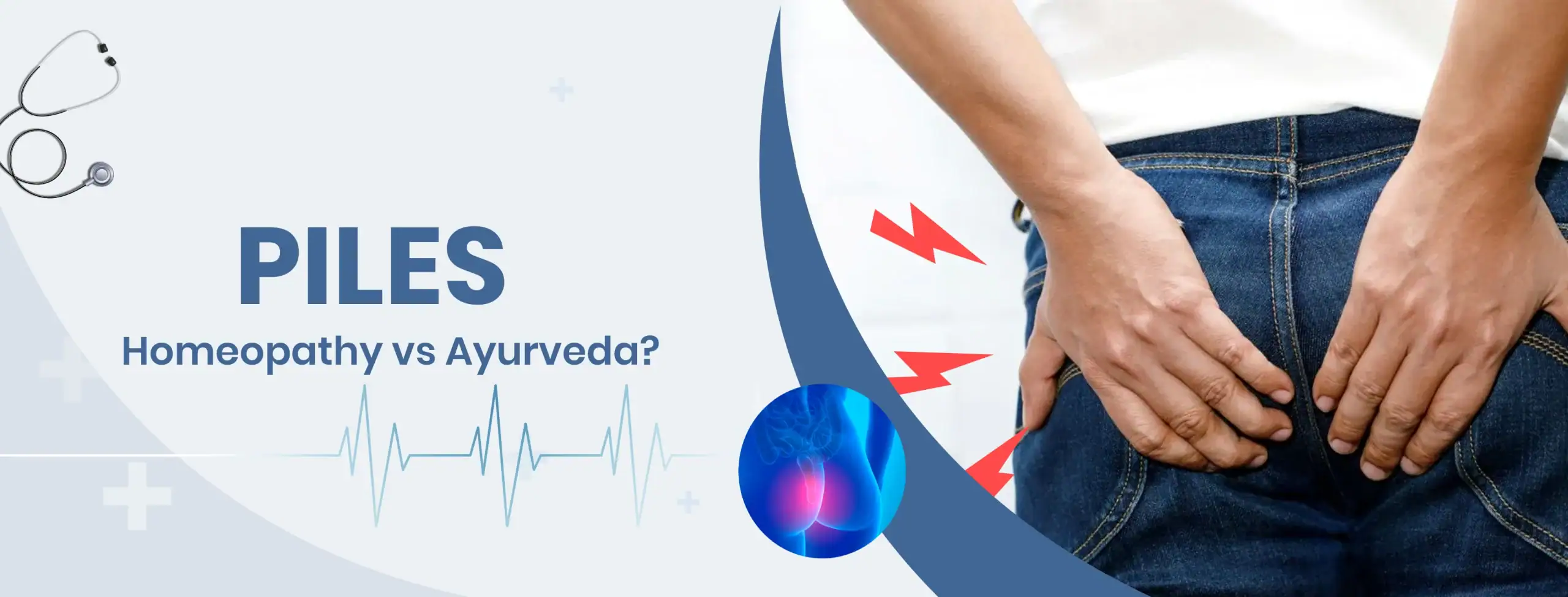 Piles Homeopathy vs Ayurveda