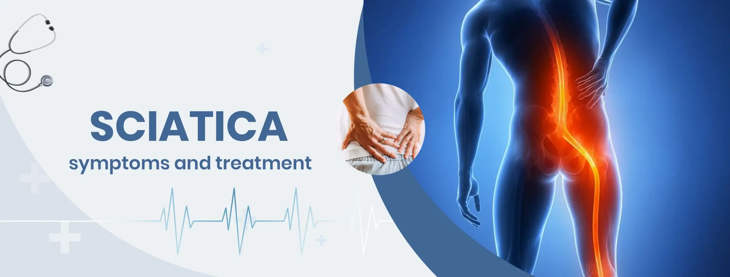 sciatica symptoms and treatment
