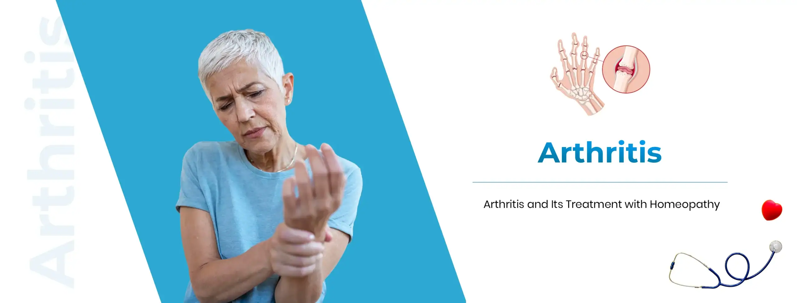 arthritis treatment with homeopathy