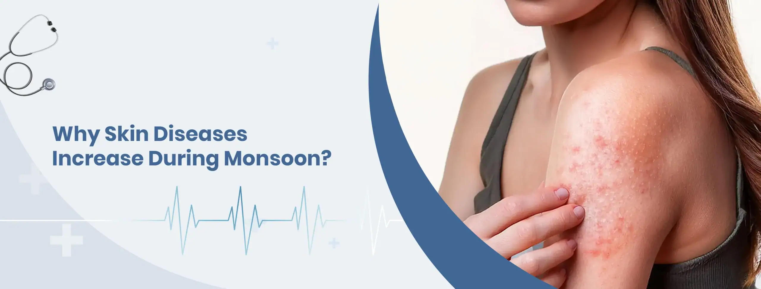 Why Skin Diseases Increase During Monsoon scaled