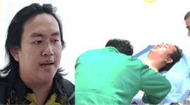 Andrie Yunus Wakil Koordinator KontraS Diserang Penyiraman Air Keras di Jakarta Pusat, Luka Bakar Hingga 24%.   