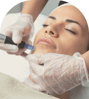Servicio Mas Popular Dermapen Servicio Mas Popular Dermapen