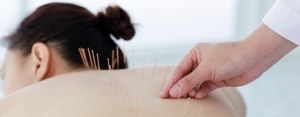 acupuntura medica sao paulo17