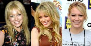 gal_teeth_hilary-duff