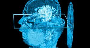 Image of gene control in brain