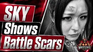 IYO SKY Reveals Bruising After Raw Attack