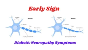 Diabetes Neuropathy Symptoms