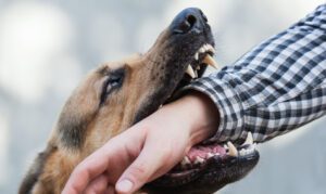 How Bradley Law Personal Injury Lawyers Can Help If You’ve Been Bitten By a Dog in Richmond Heights, MO