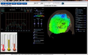 qEEGPro 19 Channel sLORETA Z-Score Training