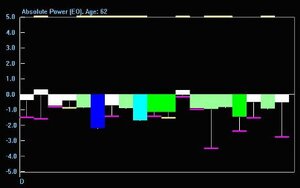 Z-Plus LZT Add-on for Atlantis