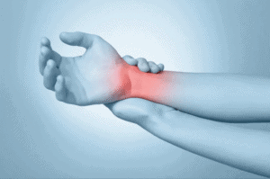 Colles’ fracture