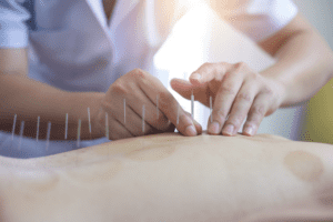acupuntura medica sao paulo3