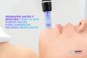 Dermapen Antes Despues