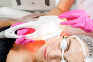 Lumecca IPL in Regina 