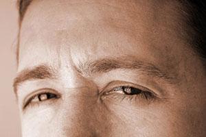 Obstructive Sleep Apnea