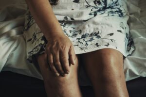 Person experiencing restless legs syndrome symptoms while lying awake in bed at night, highlighting nighttime leg discomfort and sleep disruption
