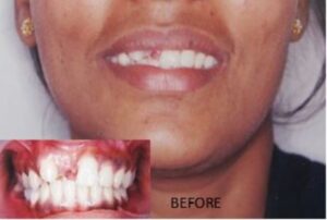 smile-esthetics-before