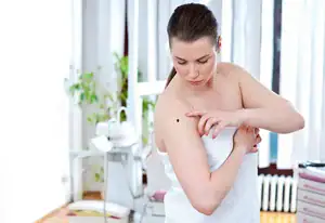 What to look for in dangerous moles