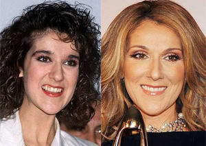 gal_teeth_zac-efron-300x213