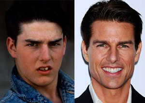 tcruise_1983_gl_18may09_pa_b