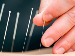 acupuntura medica sao paulo24