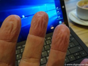 Fingerkuppen (1 von 1)