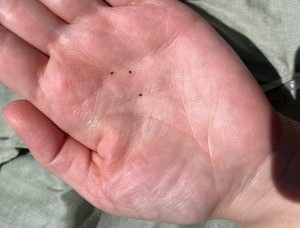 Are Bird Mites Dangerous to Humans