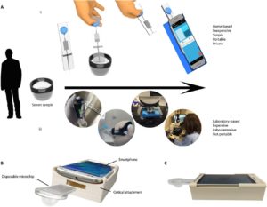 wazektomia - najnowsza metoda badania po wazektomia - nasienia zbadaj smartfonem