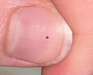 How Long Do Bird Mites Live