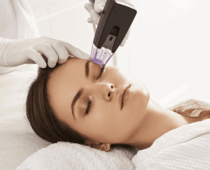 Is Your Face Showing Signs of Aging? Try Morpheus8 for Tightening Skin. 