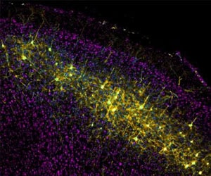 Image via Courtesy of Nicholas Wall, Salk Institute for Biological Studies