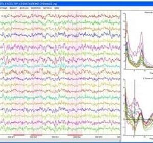 NeuroGuide Acquisition