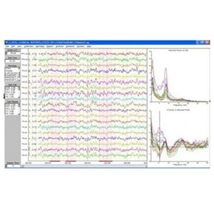 NeuroGuide EEG Collections Module