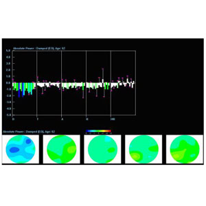 ZPlus LZT Add-on for Discovery