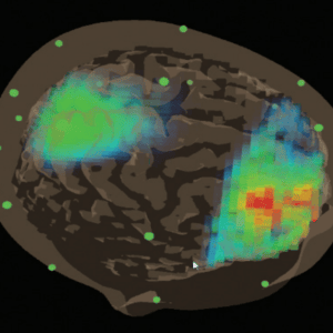 brainavatar software