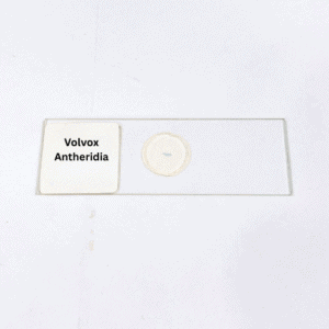 Volvox Antheridia