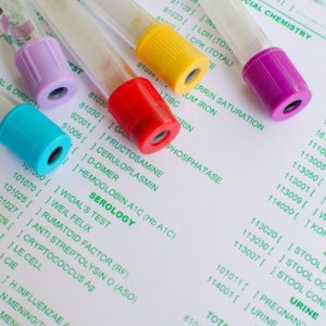 different colored blood collecting tubes and their uses