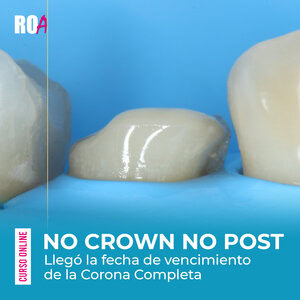 No Crown NoPost : Llegó la fecha de vencimiento de La Corona Completa .