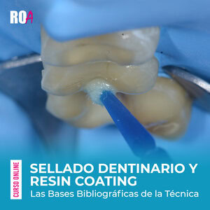 Sellado Dentinario y Resin Coating : Las Bases Bibliográficas de la Técnica .