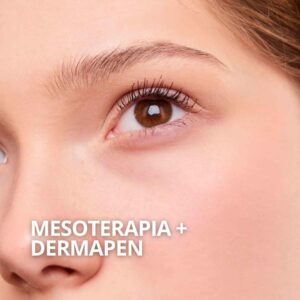 Mesoterapia y dermapen