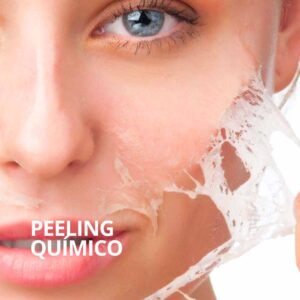 Peeling químico Sevilla