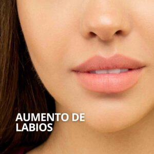Aumento de labios con acido hialurónico