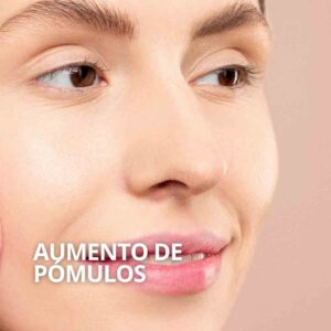 Aumento de pómulos Sevilla