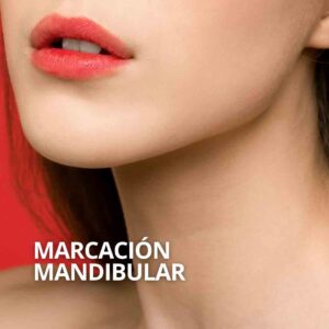 Marcación mandibular en Sevilla